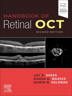 cover image of Handbook of Retinal OCT